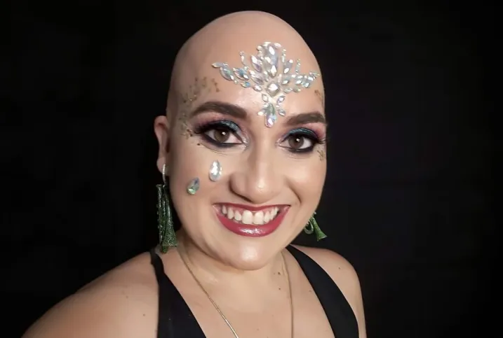 Imagem ilustrativa da imagem Mulheres contam como é viver com doença que provoca queda de cabelo