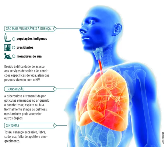 Imagem ilustrativa da imagem Casos de tuberculose aumentam 9% na região; saiba como se prevenir