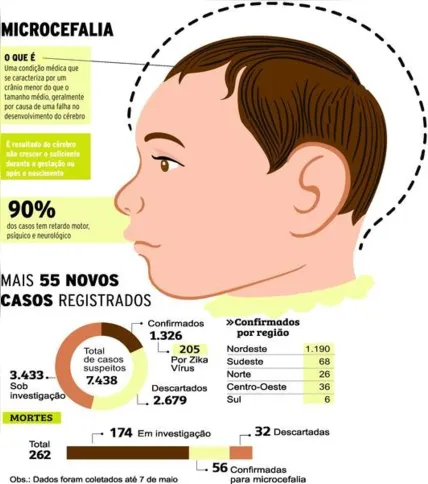 Imagem ilustrativa da imagem Casos de microcefalia crescem 4% e chegam a 1.326 no país