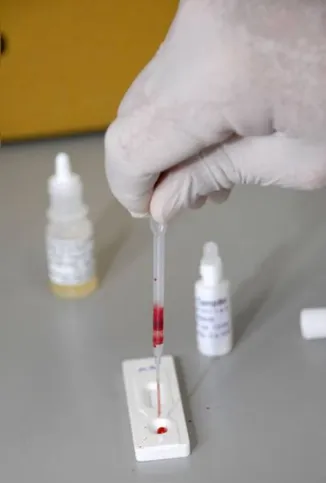 Imagem ilustrativa da imagem Casos de HIV aumentam 7%  na região da 16ª RS em 2016